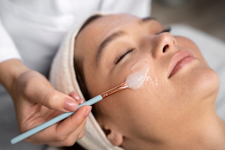 Peeling Químico